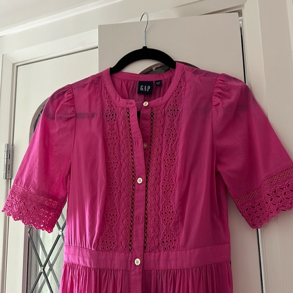 Lace button up Midi Dress - Picture 2 of 3